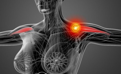 Dezmoidni tumori – gdje se razvijaju i po čemu se prepoznaju