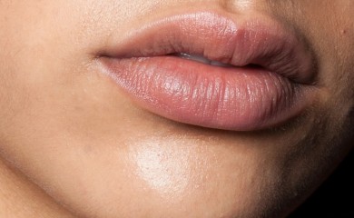 Ako primijetite OVO na usnama, odmah se javite ljekaru! Simptom OPASNE bolesti koji ne smijete da ignorišete