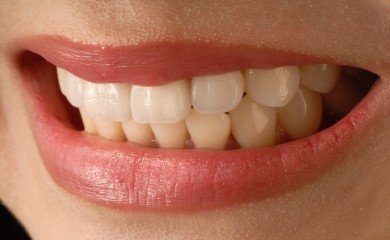 Idealan prirodni recept za izbjeljivanje zuba, pomaže i pušačima