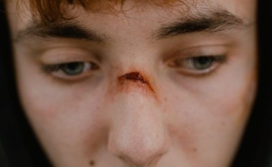 Evo zašto ranu ne treba ispirati ALKOHOLOM, cijeli život pravimo ovu GREŠKU