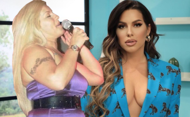 Seka Aleksić prije i poslije estetskih zahvata