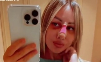 Starleta otišla u Istanbul na operaciju: Maca Diskrecija u zavojima i podlivima