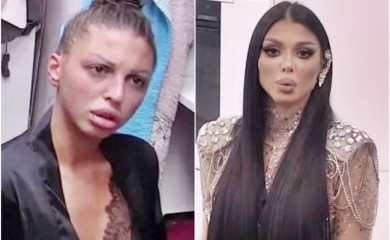 MAJA DOSAD PUKLA 20.000 EURA NA ESTETKE OPERACIJE: Poslije Zadruge 5.000 eura daje za opasan zahvat