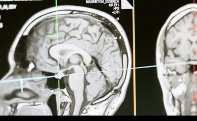 Zapanjujuća otkrića: Naučnici snimili šta se dešava u mozgu osobe na samrti