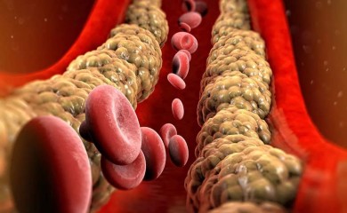 PET STVARI KOJE POMAŽU U REGULISANJU HOLESTEROLA: Šta dodati, a šta izbaciti iz ishrane?