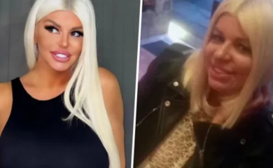 Dara Bubamara tvrdi da ne koristi fotošop, niko joj ne vjeruje - digla se bura zbog novih fotki: ''Veći nos i podočnjaci, da li je ovo ona?''