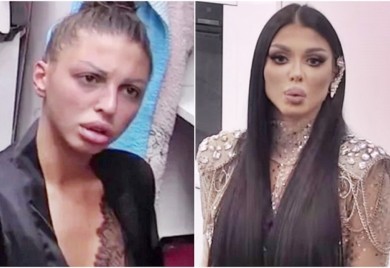 MAJA DOSAD PUKLA 20.000 EURA NA ESTETKE OPERACIJE: Poslije Zadruge 5.000 eura daje za opasan zahvat