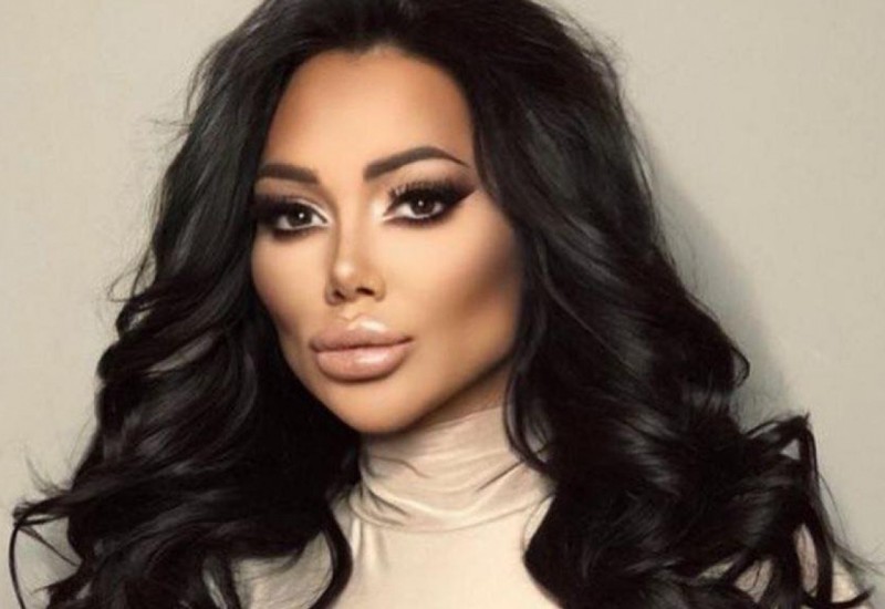 Tamara Đurić prije i poslije svih plastičnih zahvata!