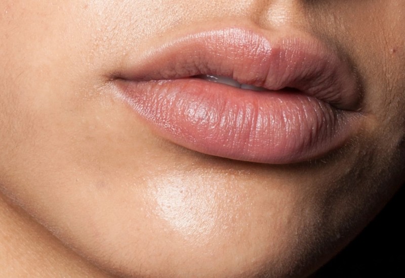 Ako primijetite OVO na usnama, odmah se javite ljekaru! Simptom OPASNE bolesti koji ne smijete da ignorišete