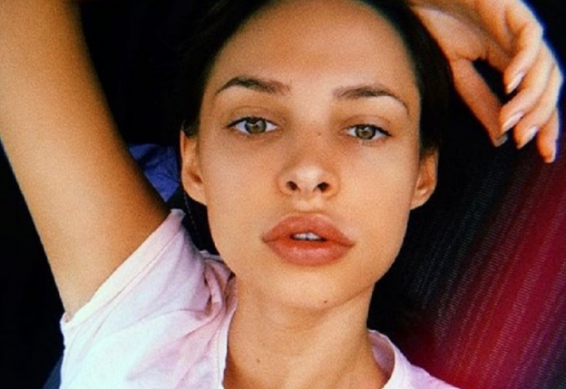 NESTAŠNA STARLETA: Nataša Šavija snimala svoje nove silikonske grudi iz svih uglova