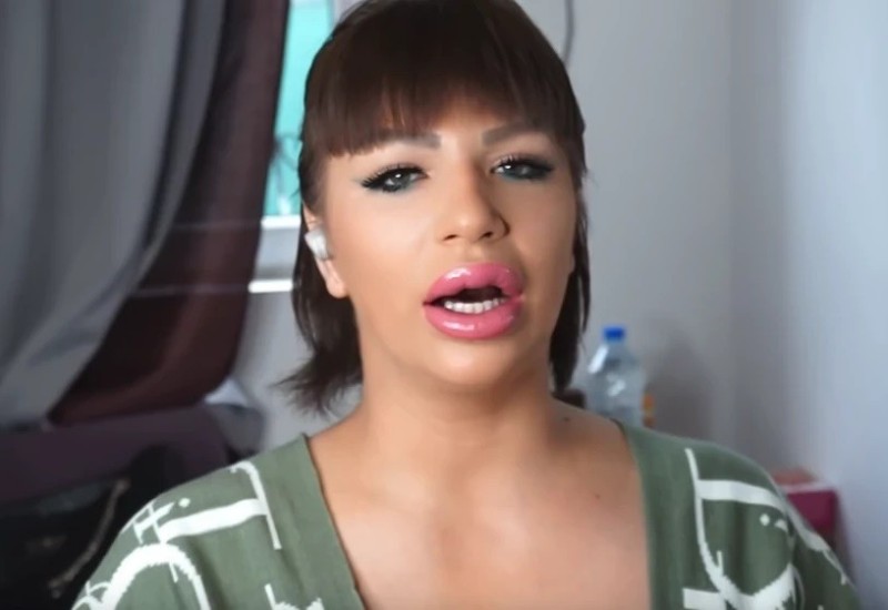 "SINOĆ GORIO BALKAN" Miljana Kulić PREPOLOVLJENA stigla u ŠIMANOVCE: Slika ŠOK promjene nakon operacije želuca ZAPANJILA SVE!