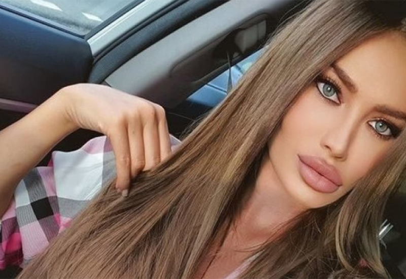 Soraja Vučelić se bori se za život: Starleta hitno operisana nakon stravične nesreće