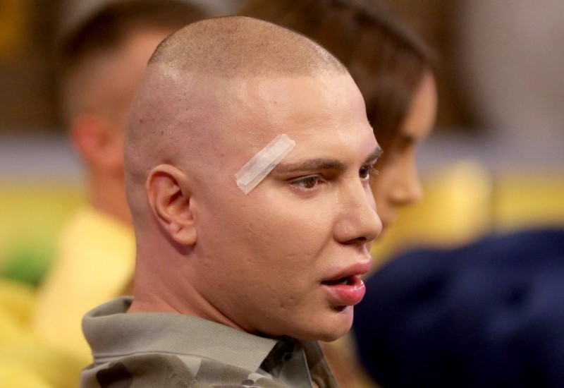 Brendon je novi rijaliti učesnik! Drastično smršao, ima 70 kg: Putovao po svijetu, našao ljubav i totalno se promijenio!