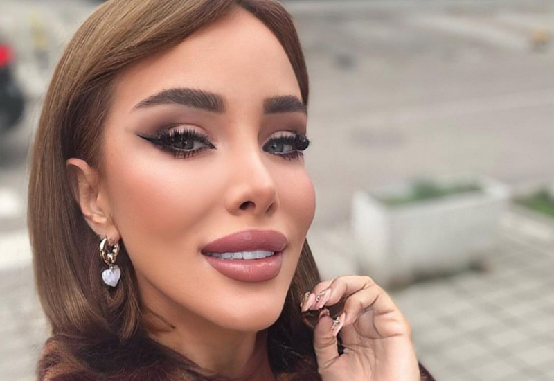 "OSMIJEH OD 6.000 EVRA" Aleksandra Subotić pukla ozbiljne pare na zube, pratioci je razapeli na mrežama! Ona im odbrusila (VIDEO)