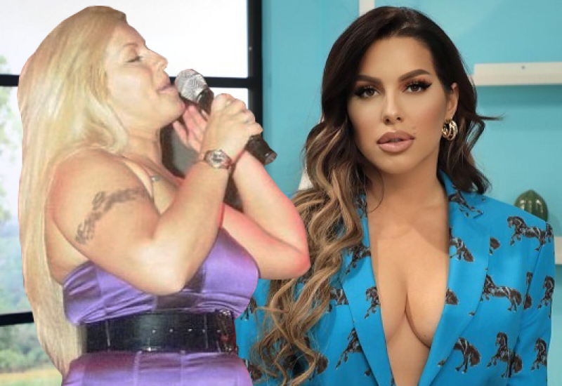 Seka Aleksić prije i poslije estetskih zahvata