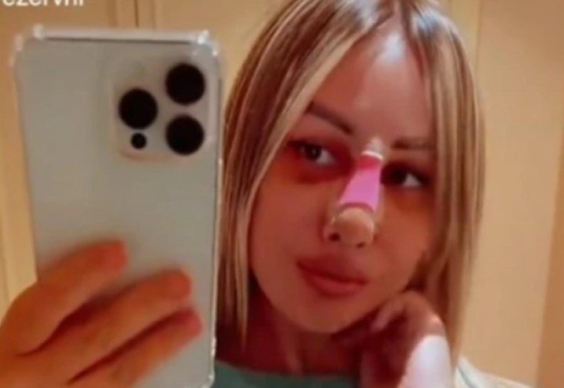 Starleta otišla u Istanbul na operaciju: Maca Diskrecija u zavojima i podlivima