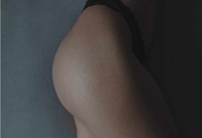 Potpuno prirodno: Napravite domaći piling za celulit