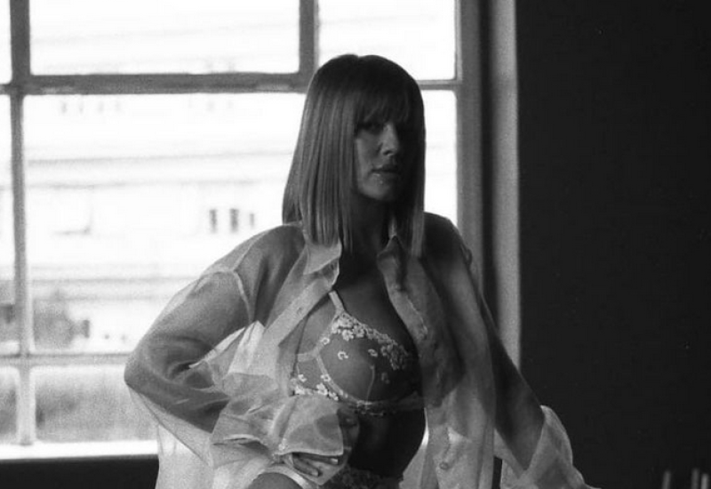 NIJE MOJA SRAMOTA: Kija Kockar u modricama nakon sukoba sa Slobom Radanovićem