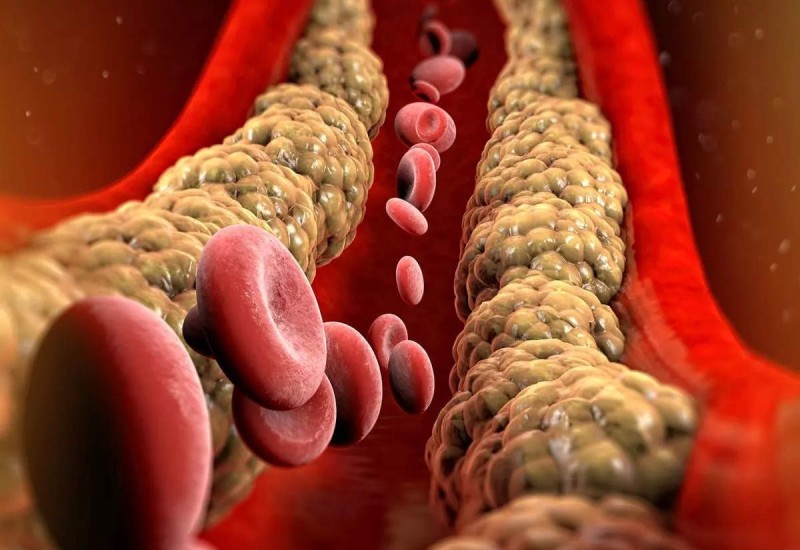 PET STVARI KOJE POMAŽU U REGULISANJU HOLESTEROLA: Šta dodati, a šta izbaciti iz ishrane?