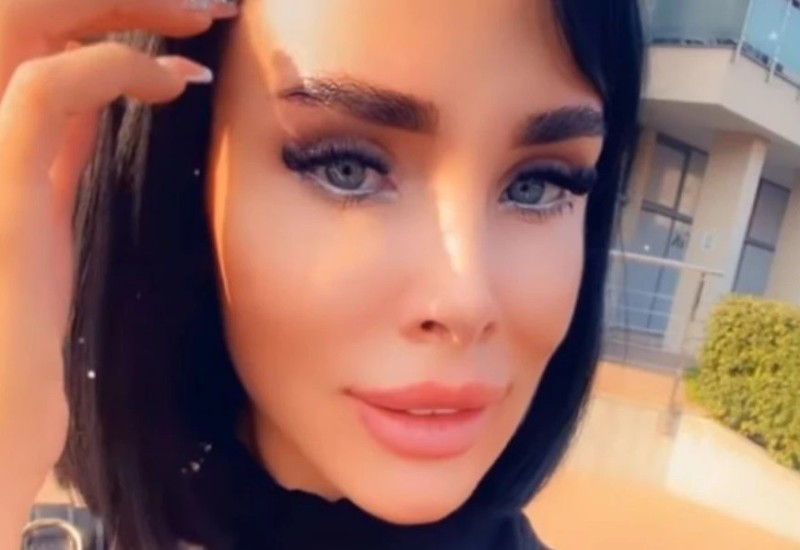 OTIŠLA NA REMONT! Lice Aleksandre Subotić je sada DRUGAČIJE, evo kako izgleda nakon TRETMANA