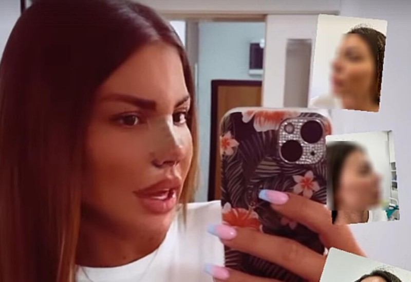 SJEKLI SU MI REBRO JER VIŠE NISAM IMALA HRSKAVICU! Dragana Mitar otrkrila jezive detalje SEDME OPERACIJE NOSA, spomenula i Edisa